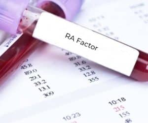 RA factor