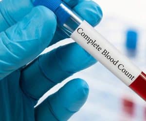 Complete Blood Count (CBC) Test