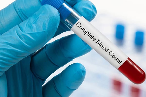 Complete Blood Count (CBC) Test