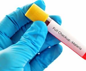 Full Checkup-Malaria