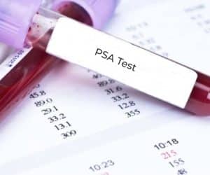 PSA Test