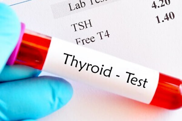Thyroid Test at Home in Jodhpur