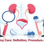 Urostomy Care: Definition and more